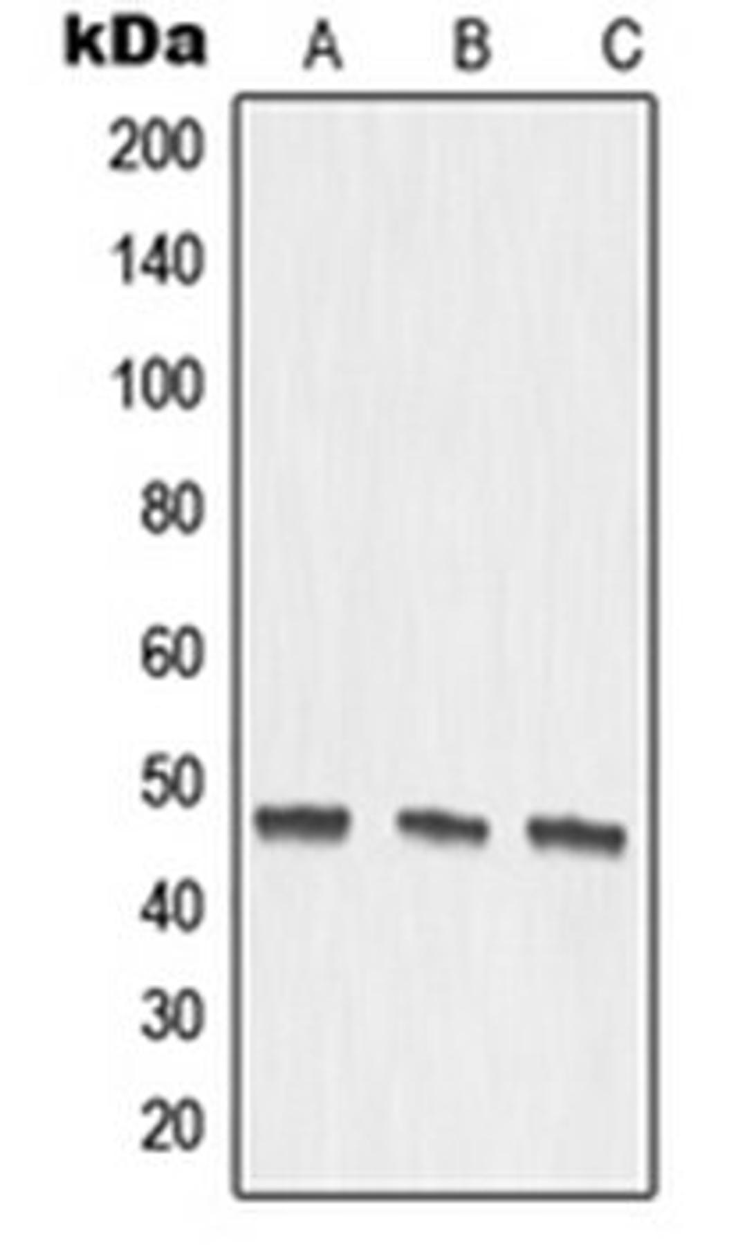 Western blot analysis of DLD (Lane 1), mouse kidney (Lane 2), rat kidney (Lane 3) whole cell lysates using MMP27 antibody