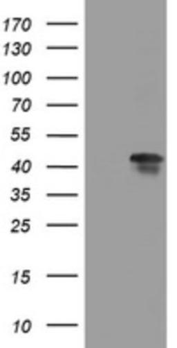 Western Blot: TIA1 Antibody (1D7) [NBP2-46132] - Analysis of HEK293T cells were transfected with the pCMV6-ENTRY control (Left lane) or pCMV6-ENTRY TIA1.