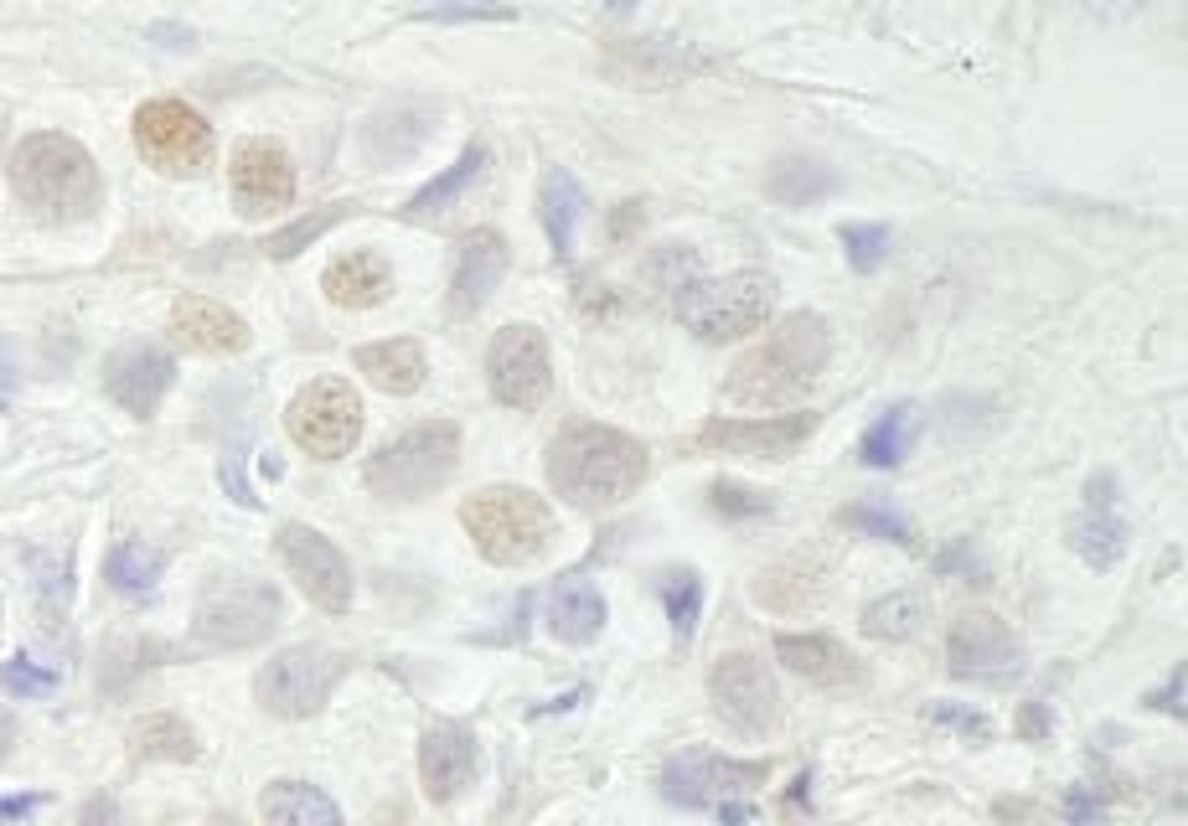 Detection of human BCAS3 by immunohistochemistry.