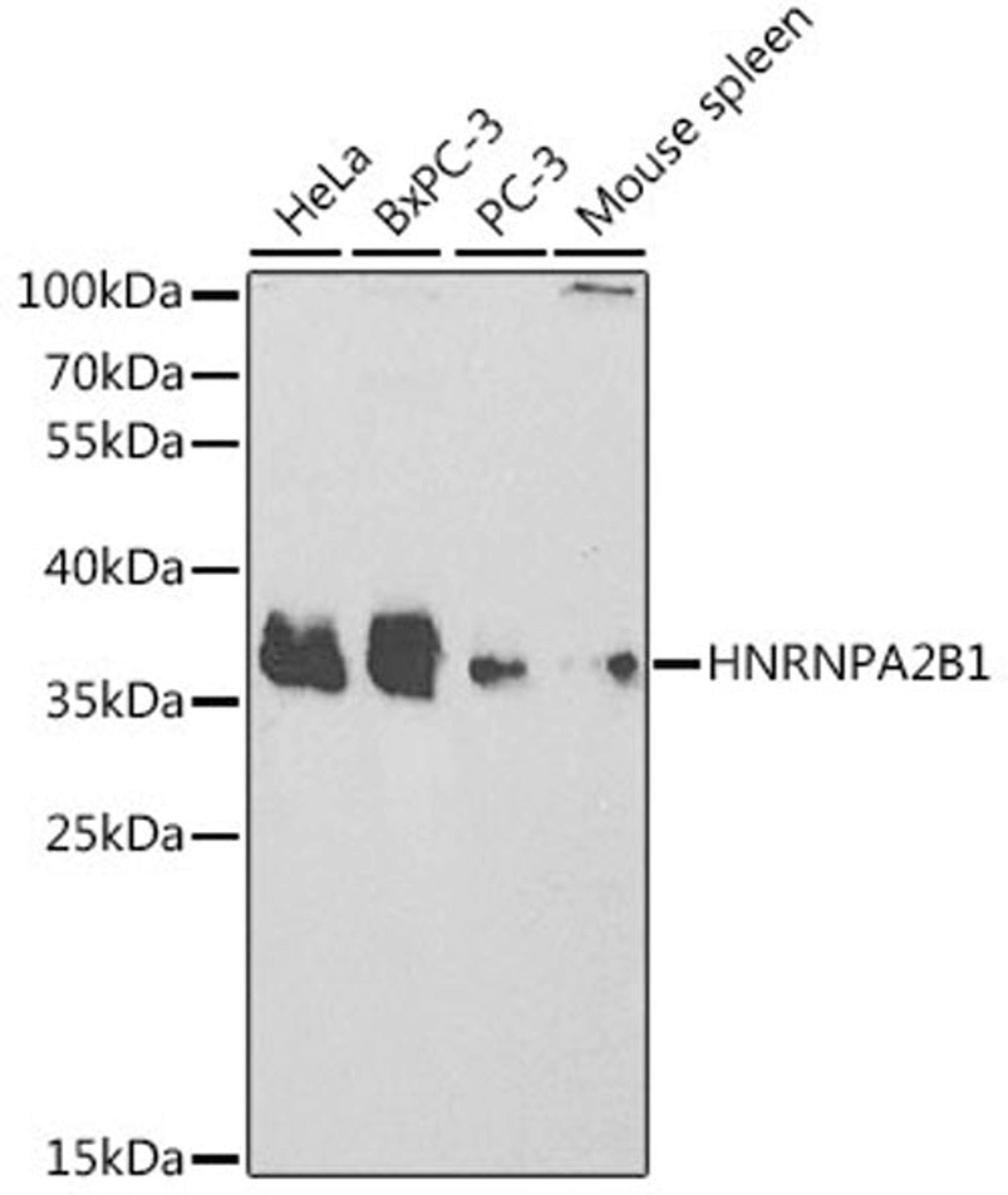 Western blot - HNRNPA2B1 antibody (A1162)