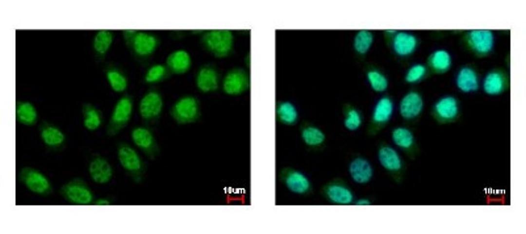 Immunocytochemistry/Immunofluorescence: ZMYND11 Antibody [NBP2-20960] - Detection of ZMYND11 protein at nucleus by immunofluorescent analysis. Sample: A431 cells were fixed in 4% paraformaldehyde at RT for 15 min. Green: ZMYND11 protein stained by BS69 antibody diluted at 1:500. Blue: Hoechst 33343 staining.