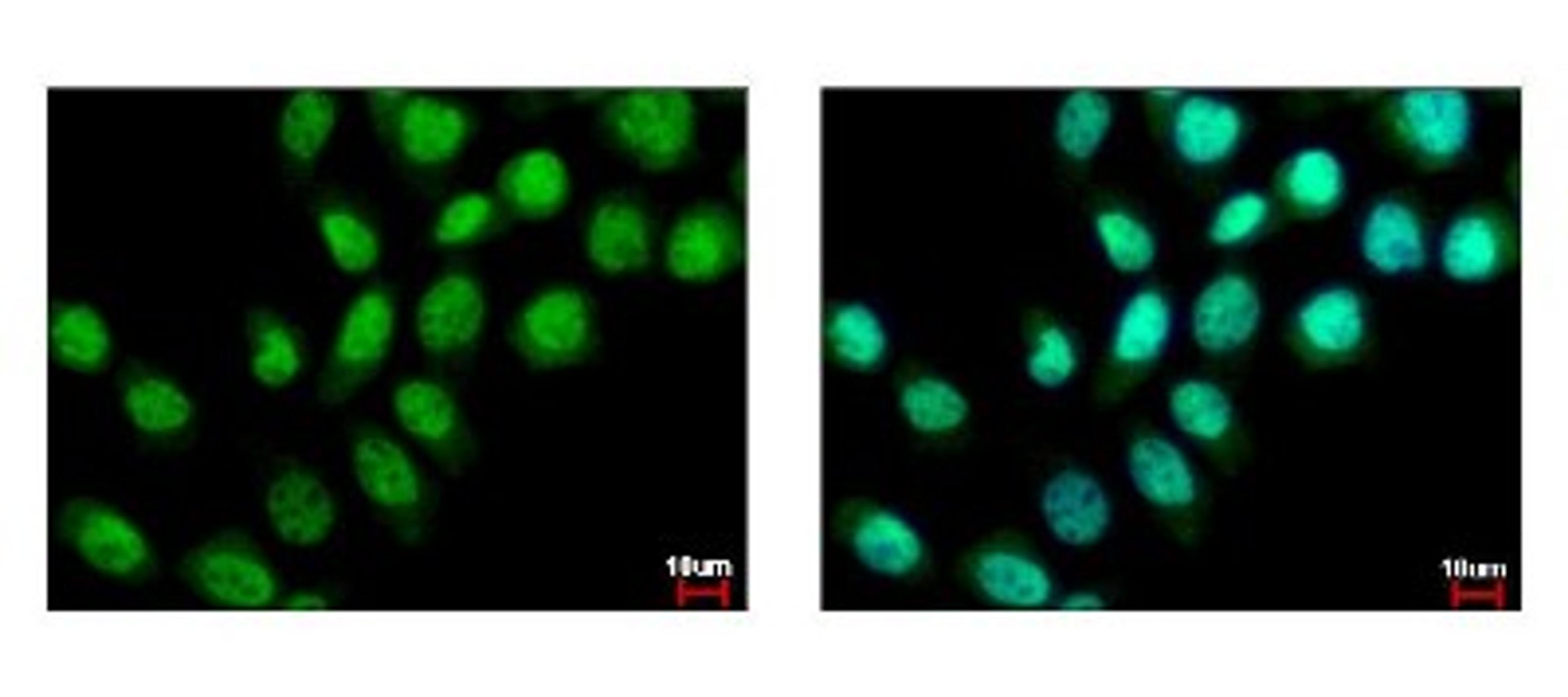 Immunocytochemistry/Immunofluorescence: ZMYND11 Antibody [NBP2-20960] - Detection of ZMYND11 protein at nucleus by immunofluorescent analysis. Sample: A431 cells were fixed in 4% paraformaldehyde at RT for 15 min. Green: ZMYND11 protein stained by BS69 antibody diluted at 1:500. Blue: Hoechst 33343 staining.