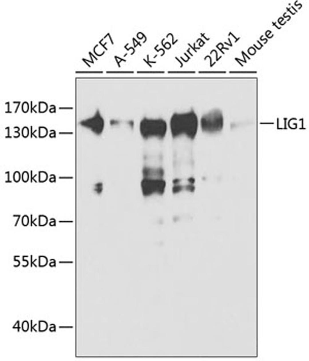 Western blot - LIG1 antibody (A1858)