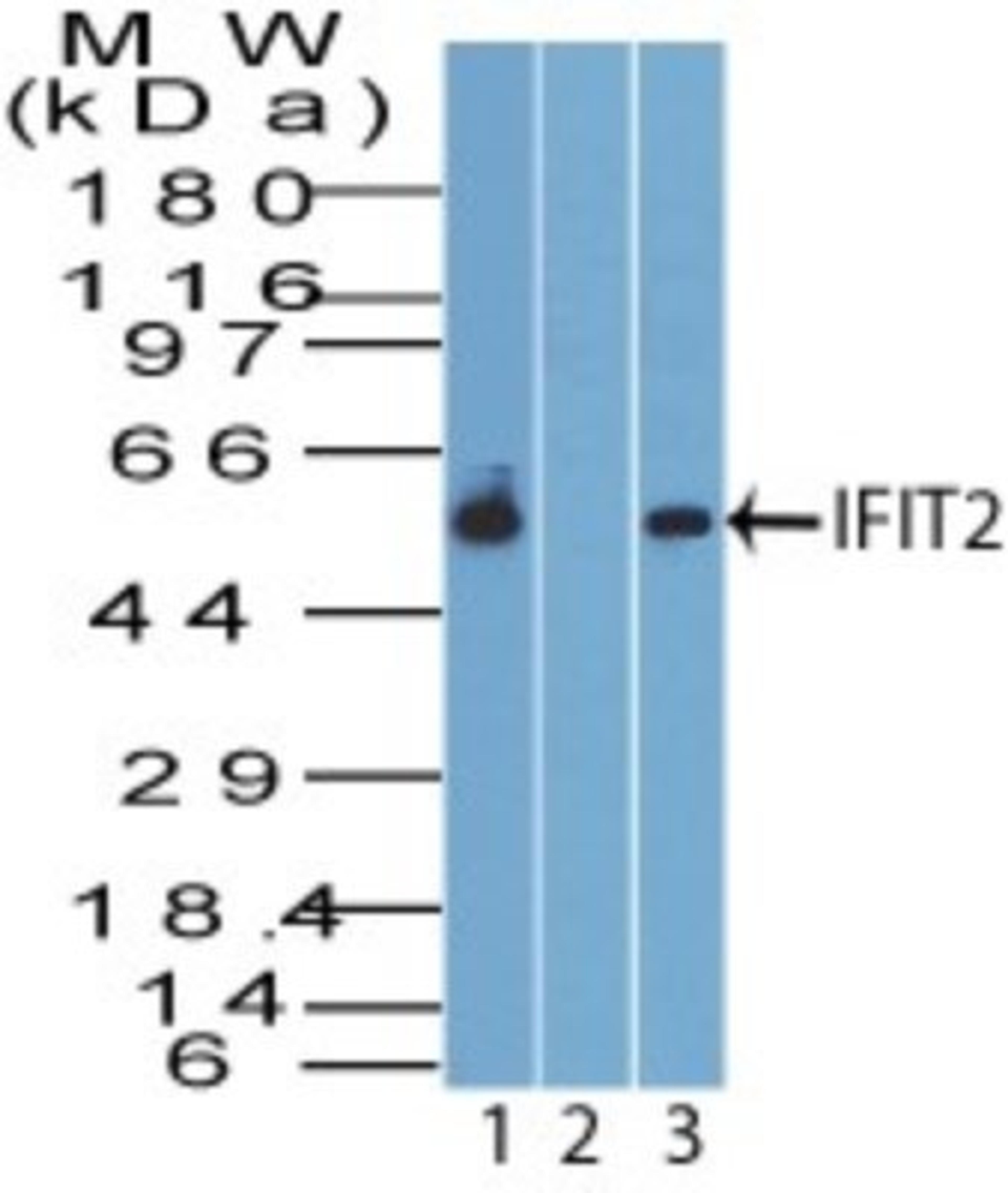 Western Blot: IFIT2 Antibody [NBP2-15180] - Analysis of IFIT2 in human K562 lysate in the 1) absence and 2) presence of immunizing peptide, and 3) mouse RAW lysate probed with 4 ug/ml of IFIT2 antibody. Goat anti-rabbit Ig HRP secondary antibody and PicoTect ECL substrate solution were used for this test.