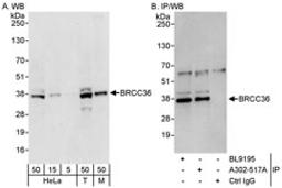 Detection of human and mouse BRCC36 by western blot (h&m) and immunoprecipitation (h).