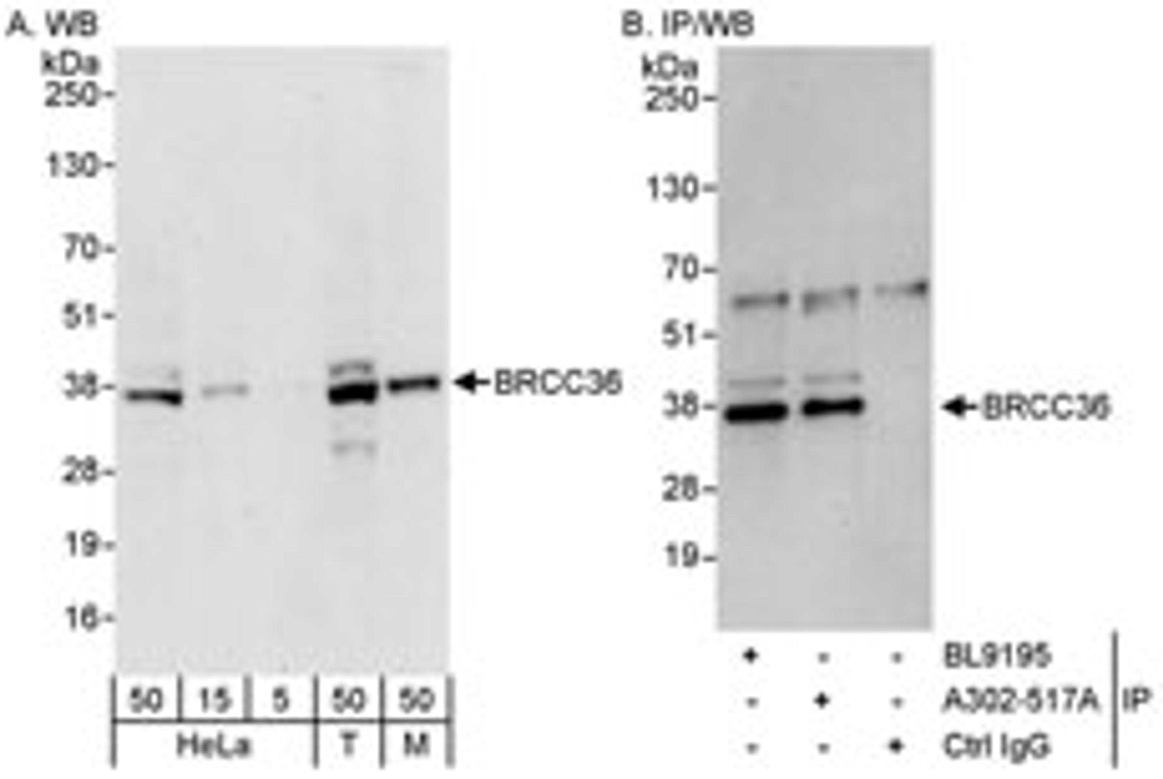 Detection of human and mouse BRCC36 by western blot (h&m) and immunoprecipitation (h).