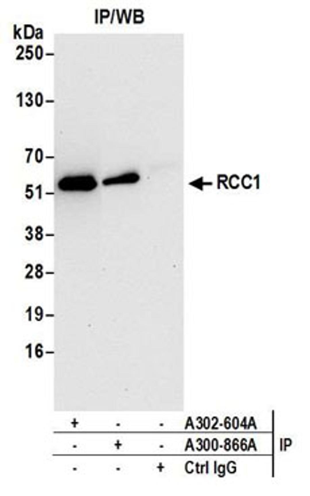 Detection of human RCC1 by western blot of immunoprecipitates.