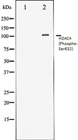 Western blot analysis of Jurkat whole cell lysates using HDAC4 (Phospho-Ser632) antibody, The lane on the left is treated with the antigen-specific peptide.