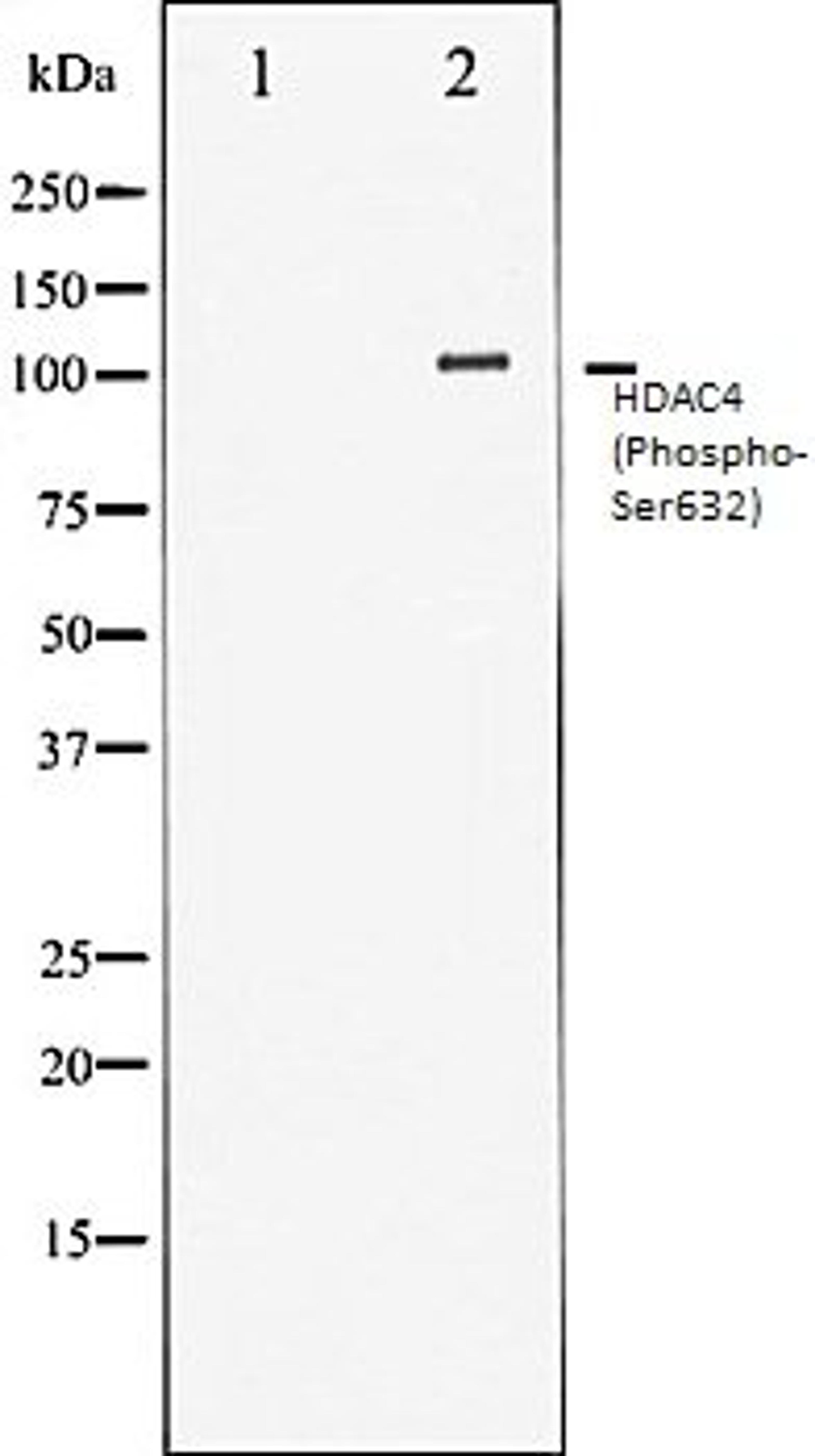 Western blot analysis of Jurkat whole cell lysates using HDAC4 (Phospho-Ser632) antibody, The lane on the left is treated with the antigen-specific peptide.