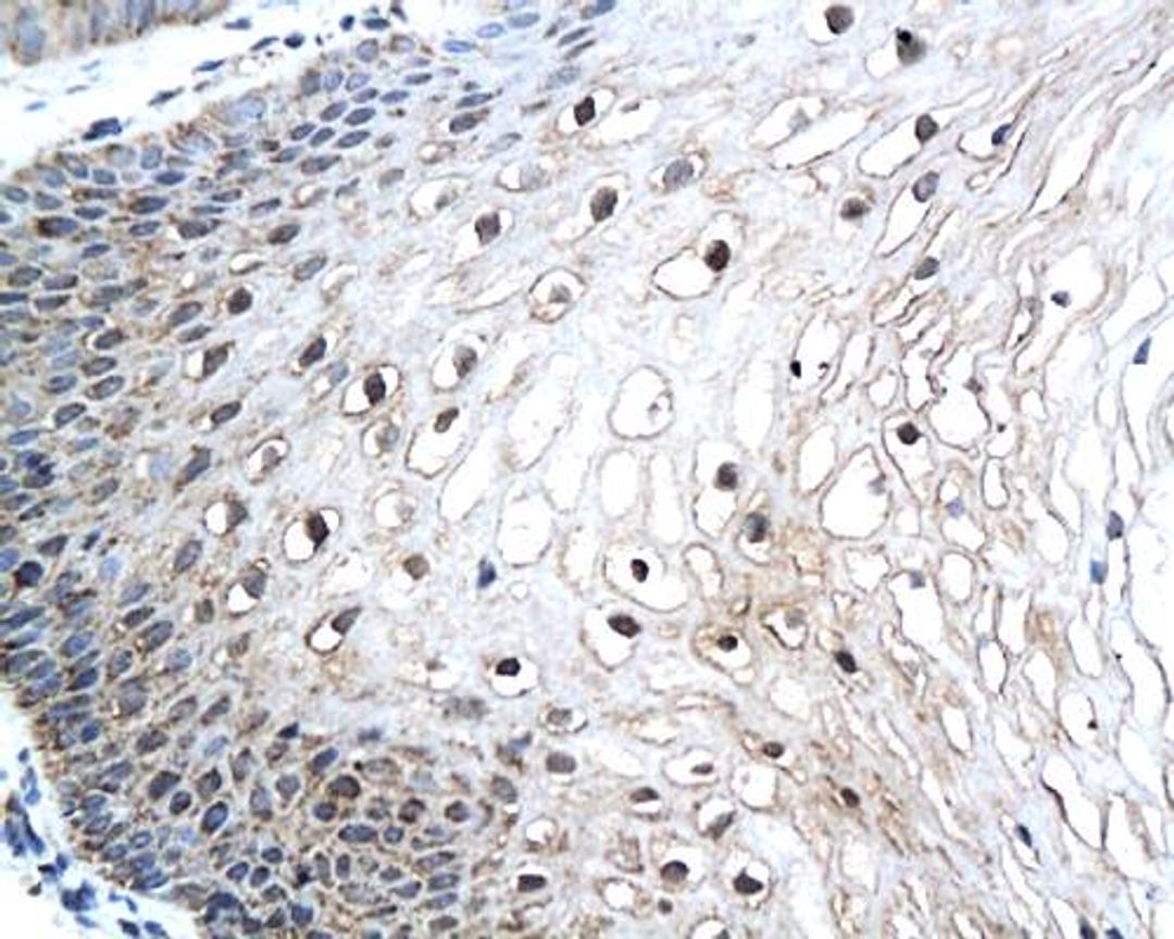 Immunohistochemical analysis of paraffin-embedded human uterus tissue using HPV16 E7 antibody 