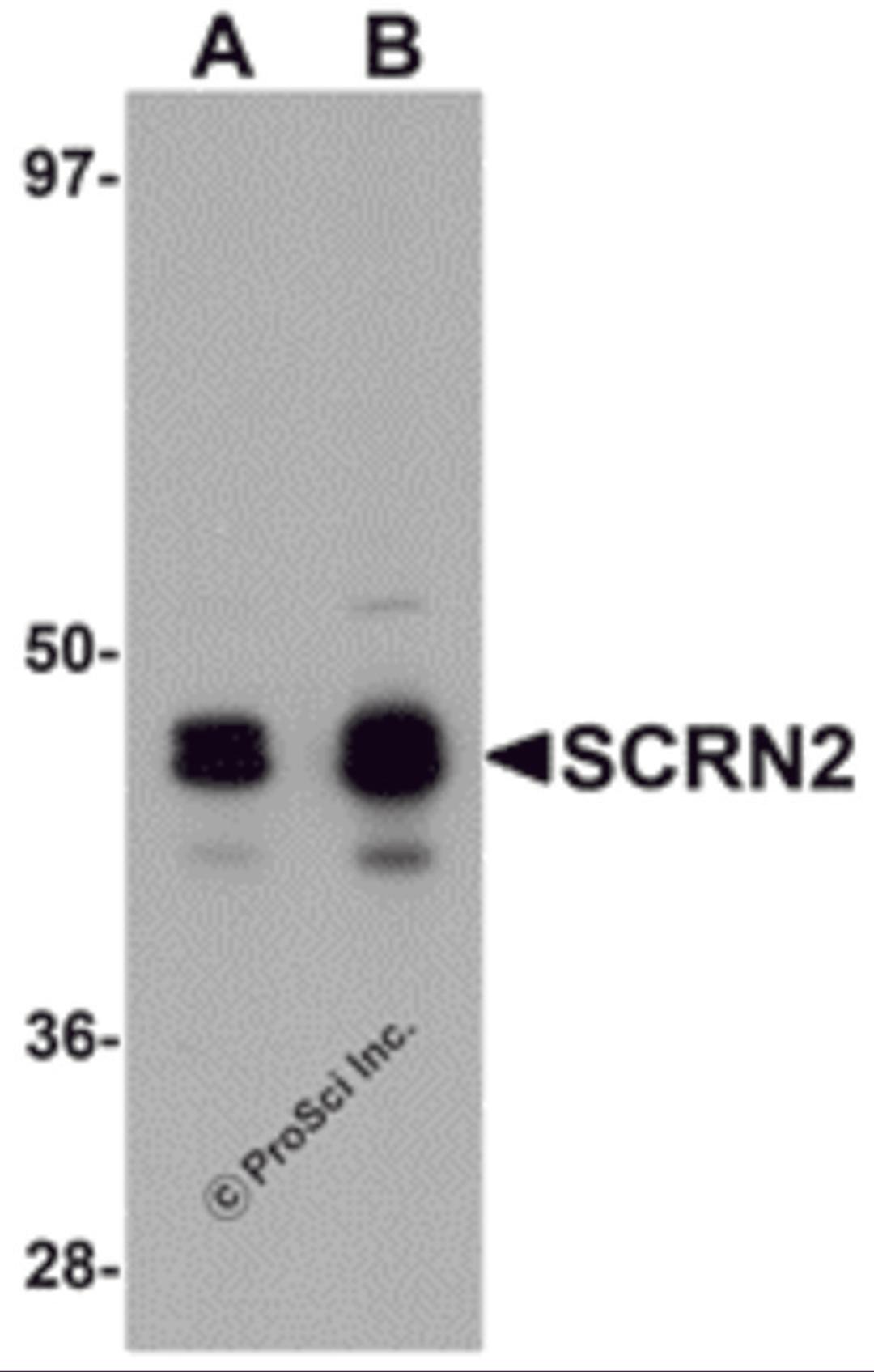 Western blot analysis of SCRN2 in 293 cell tissue lysate with SCRN2 antibody at (A) 0.5 and (B) 1 μg/mL.