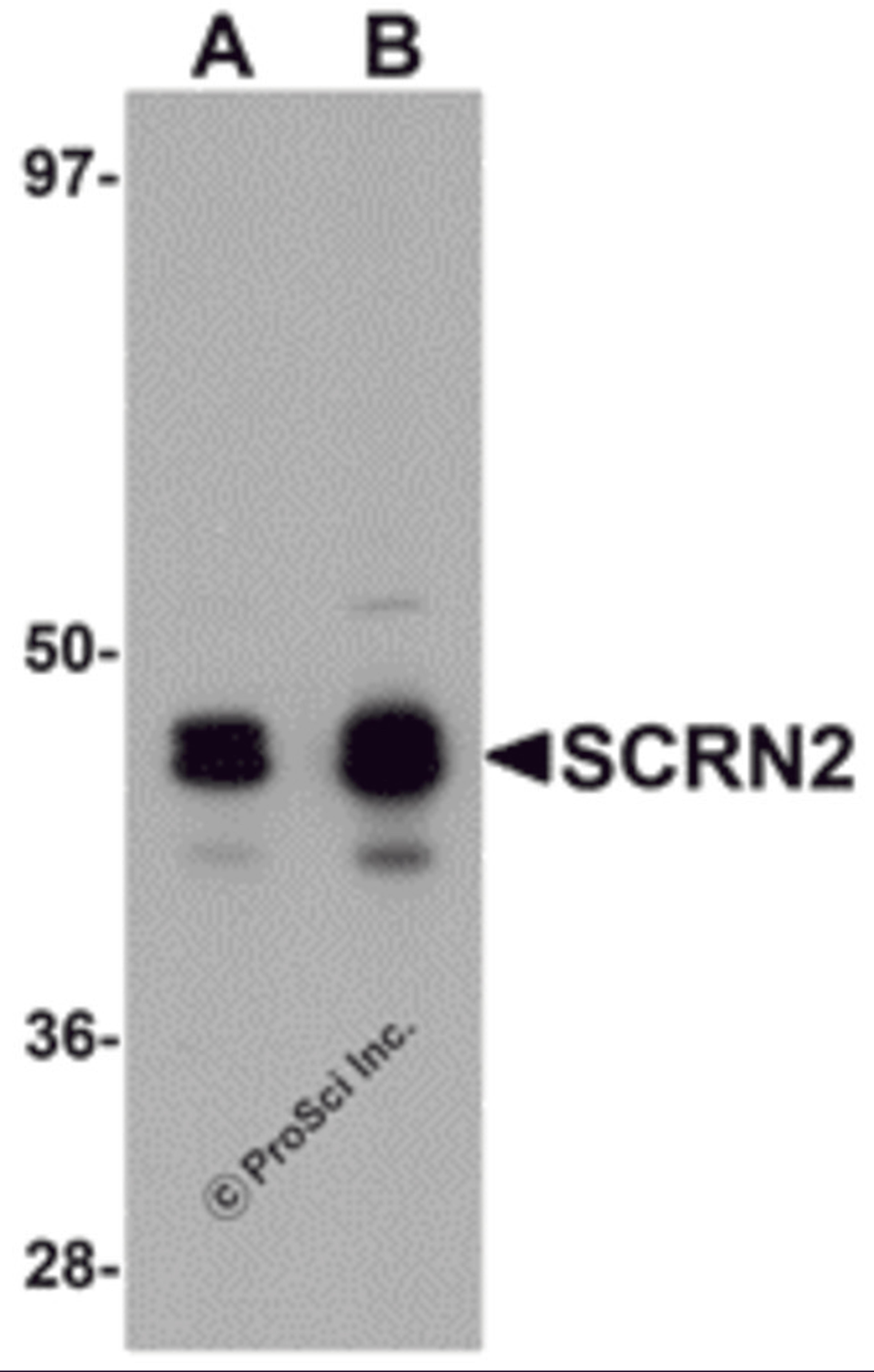 Western blot analysis of SCRN2 in 293 cell tissue lysate with SCRN2 antibody at (A) 0.5 and (B) 1 μg/mL.