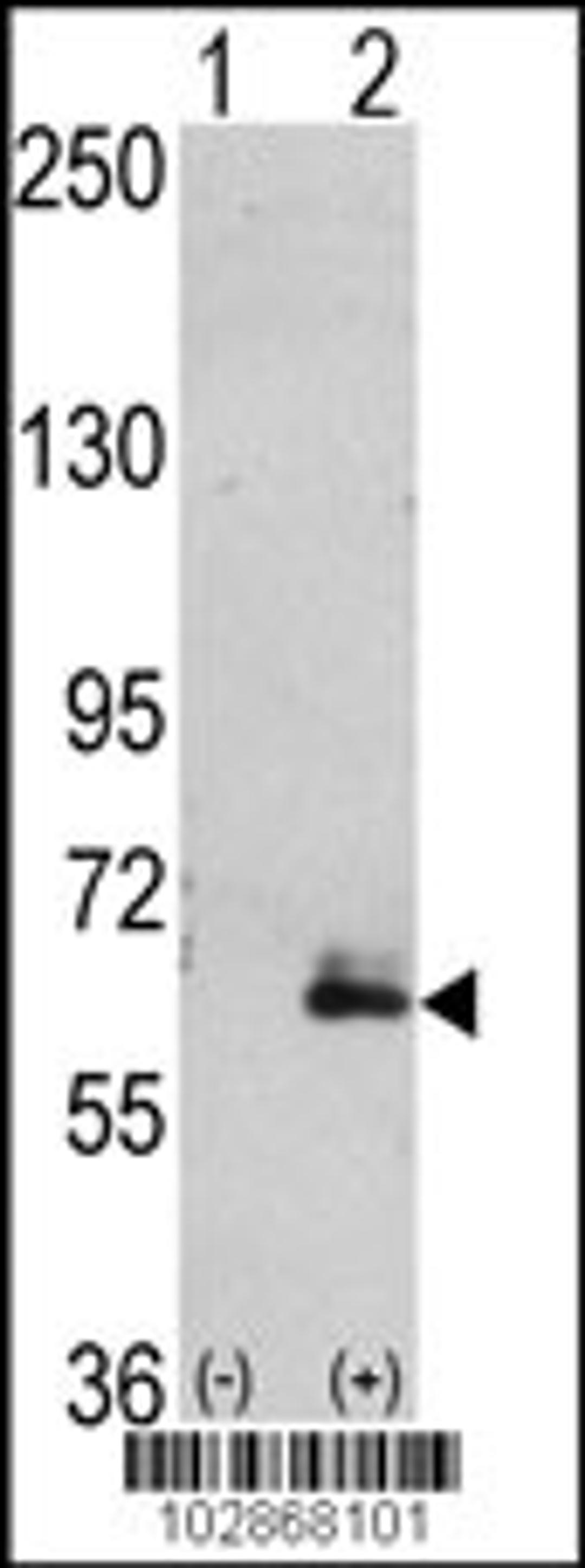 Western blot analysis of hMAP2-Q425 using rabbit polyclonal hMAP2-Q425 Antibody using 293 cell lysates (2 ug/lane) either nontransfected (Lane 1) or transiently transfected with the hMAP2-Q425 gene (Lane 2).