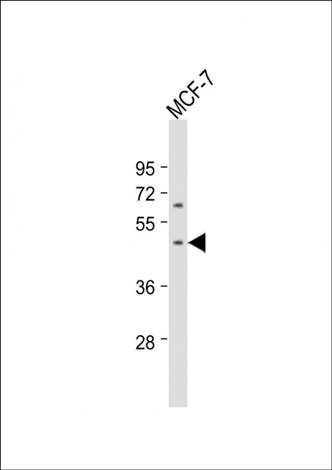 Western Blot at 1:1000 dilution + MCF-7 whole cell lysate Lysates/proteins at 20 ug per lane.