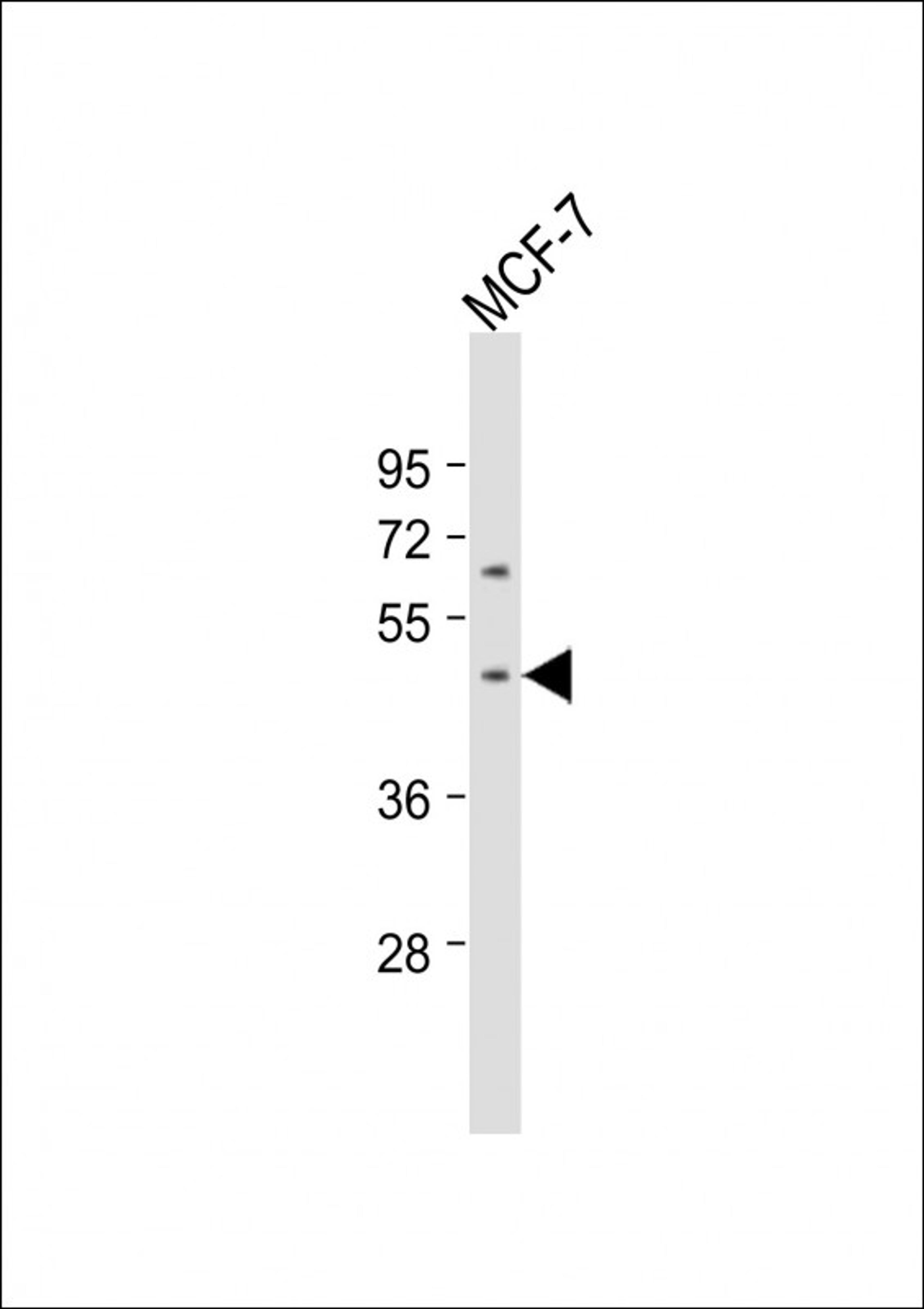 Western Blot at 1:1000 dilution + MCF-7 whole cell lysate Lysates/proteins at 20 ug per lane.