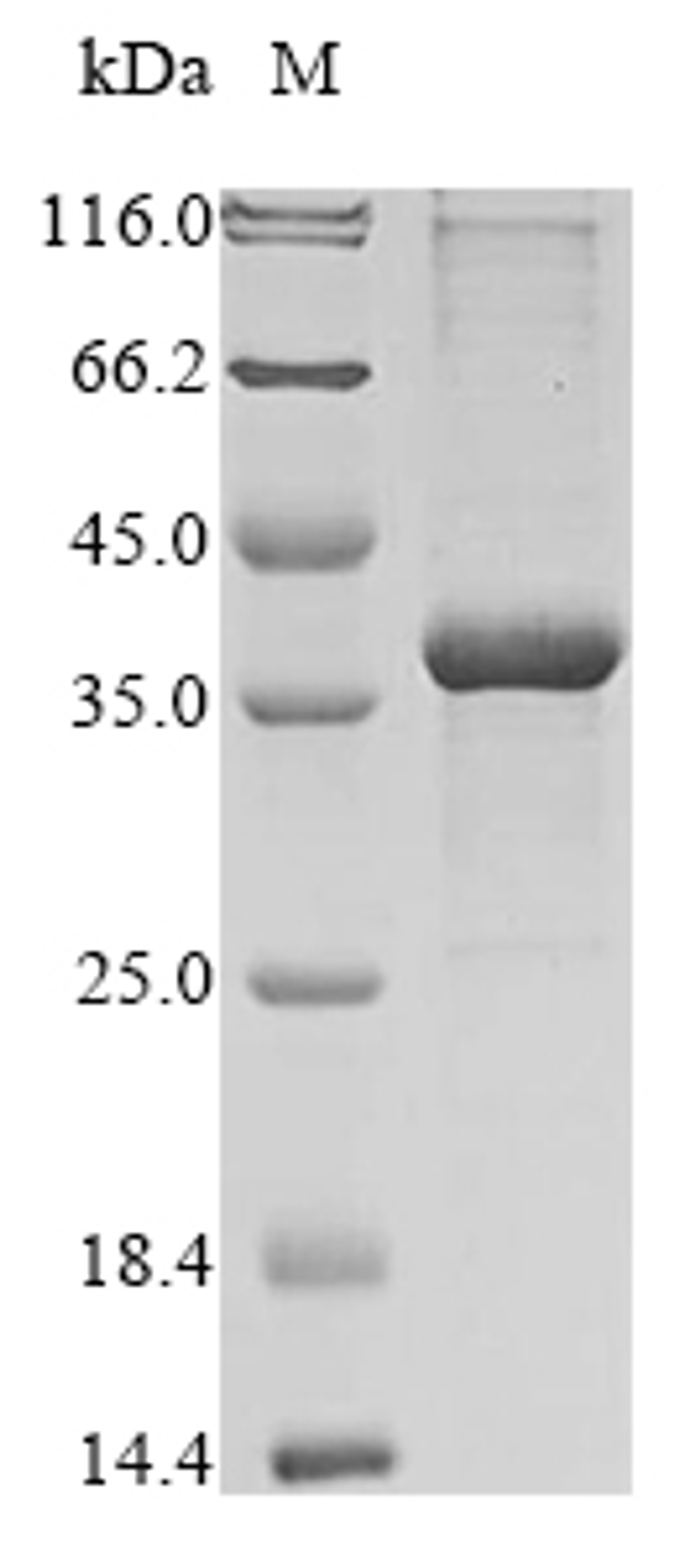 (Tris-Glycine gel) Discontinuous SDS-PAGE (reduced) with 5% enrichment gel and 15% separation gel.
