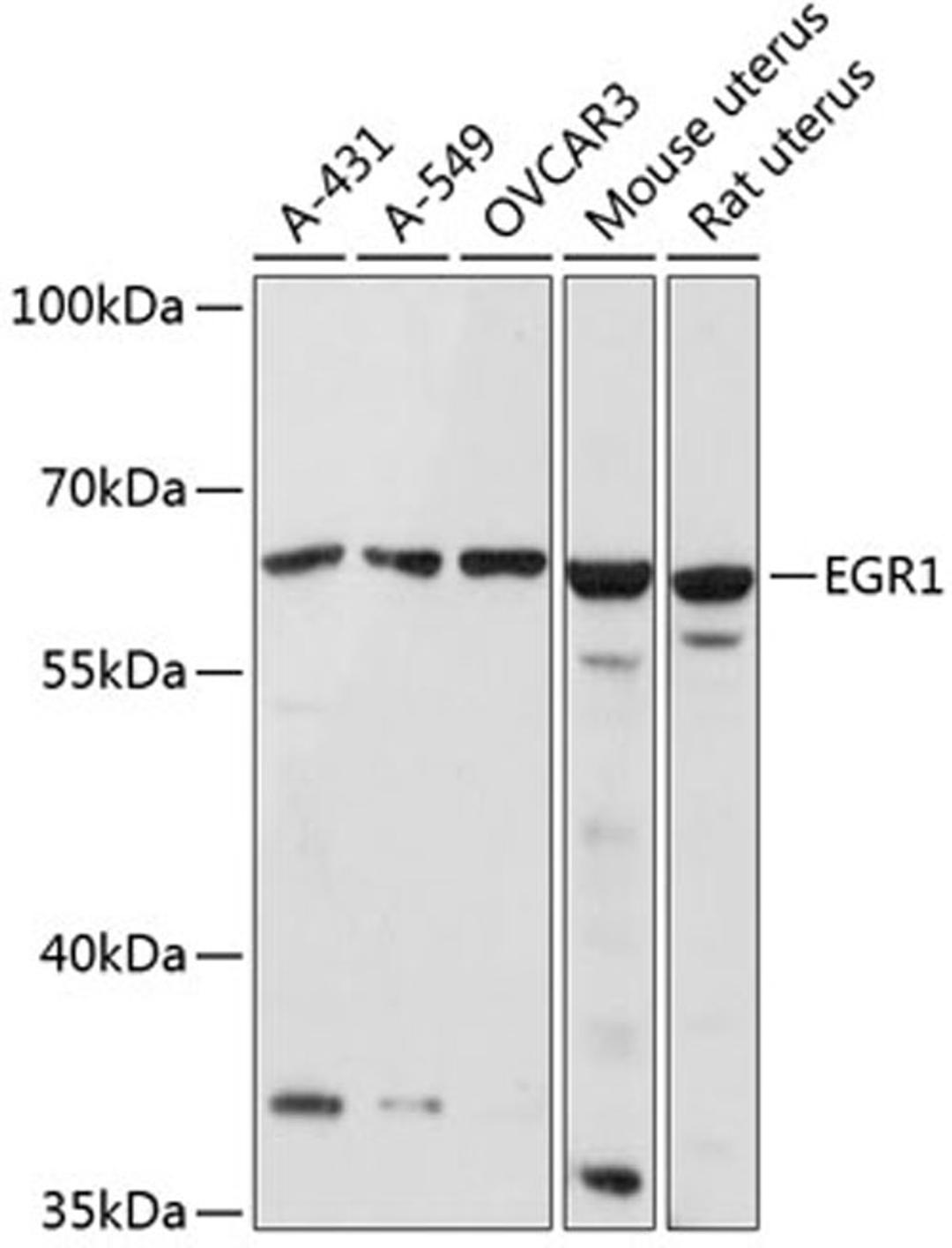 Western blot - EGR1 antibody (A2722)