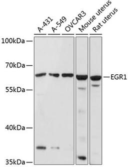 Western blot - EGR1 antibody (A2722)