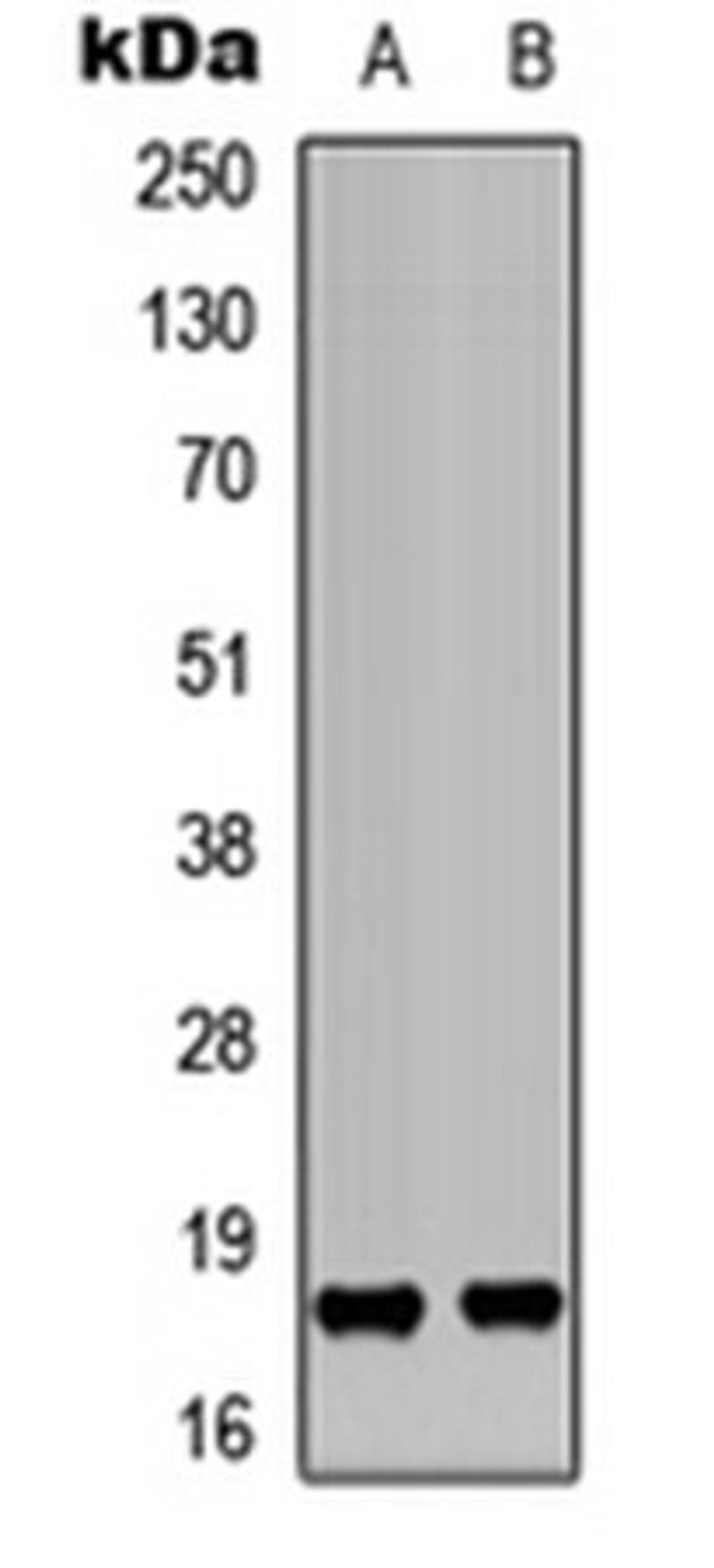 Western blot analysis of K562 (Lane 1), HEK293T (Lane 2) whole cell lysates using KEPI antibody