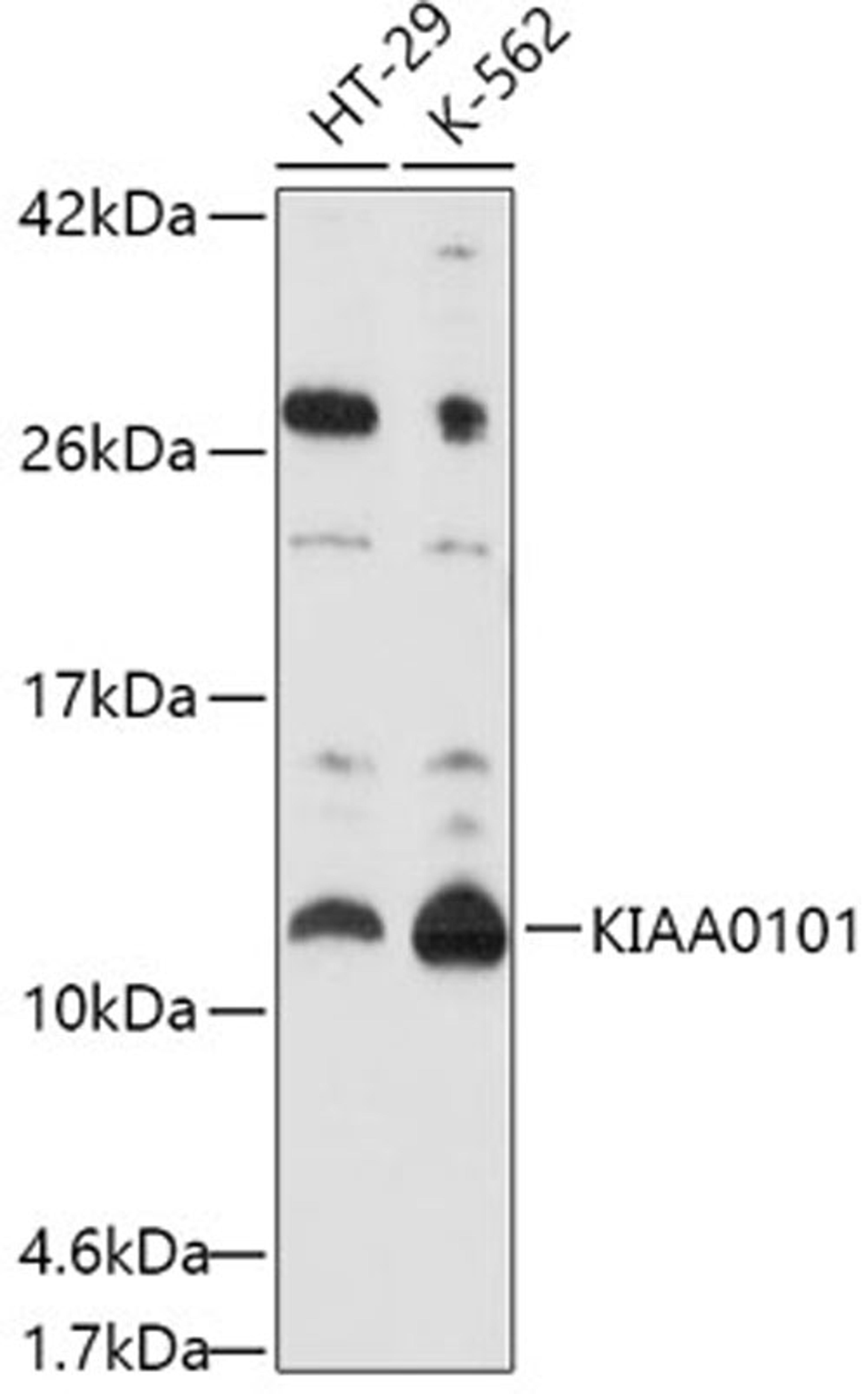 Western blot - KIAA0101 antibody (A10357)