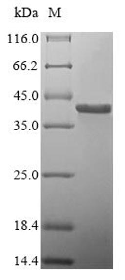 (Tris-Glycine gel) Discontinuous SDS-PAGE (reduced) with 5% enrichment gel and 15% separation gel.