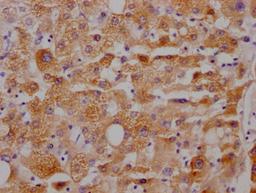 IHC image of CSB-RA153677A0HU diluted at 1:100 and staining in paraffin-embedded human liver tissue performed on a Leica BondTM system. After dewaxing and hydration, antigen retrieval was mediated by high pressure in a citrate buffer (pH 6.0). Section was blocked with 10% normal goat serum 30min at RT. Then primary antibody (1% BSA) was incubated at 4℃ overnight. The primary is detected by a Goat anti-rabbit IgG polymer labeled by HRP and visualized using 0.05% DAB.