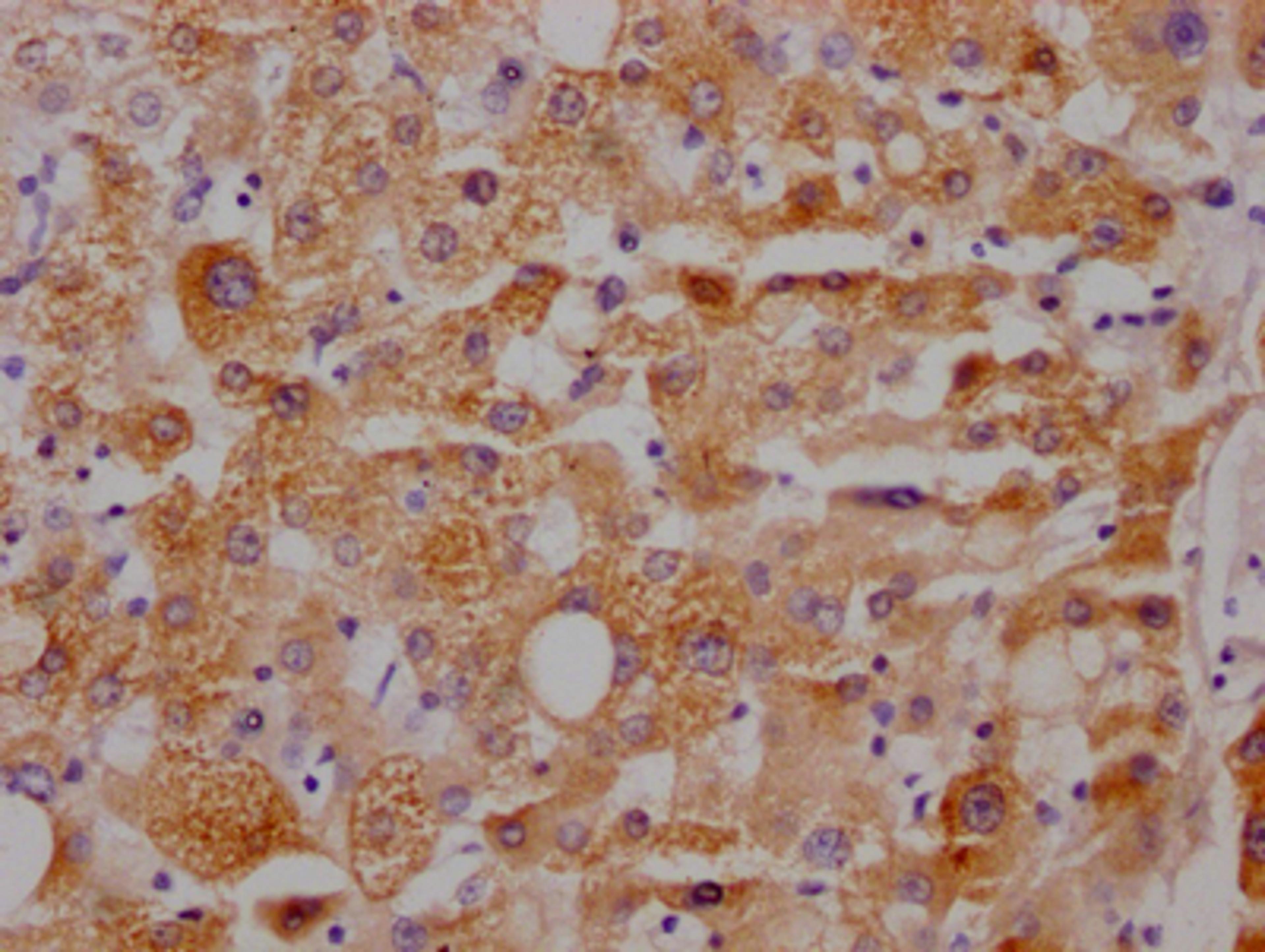 IHC image of CSB-RA153677A0HU diluted at 1:100 and staining in paraffin-embedded human liver tissue performed on a Leica BondTM system. After dewaxing and hydration, antigen retrieval was mediated by high pressure in a citrate buffer (pH 6.0). Section was blocked with 10% normal goat serum 30min at RT. Then primary antibody (1% BSA) was incubated at 4℃ overnight. The primary is detected by a Goat anti-rabbit IgG polymer labeled by HRP and visualized using 0.05% DAB.