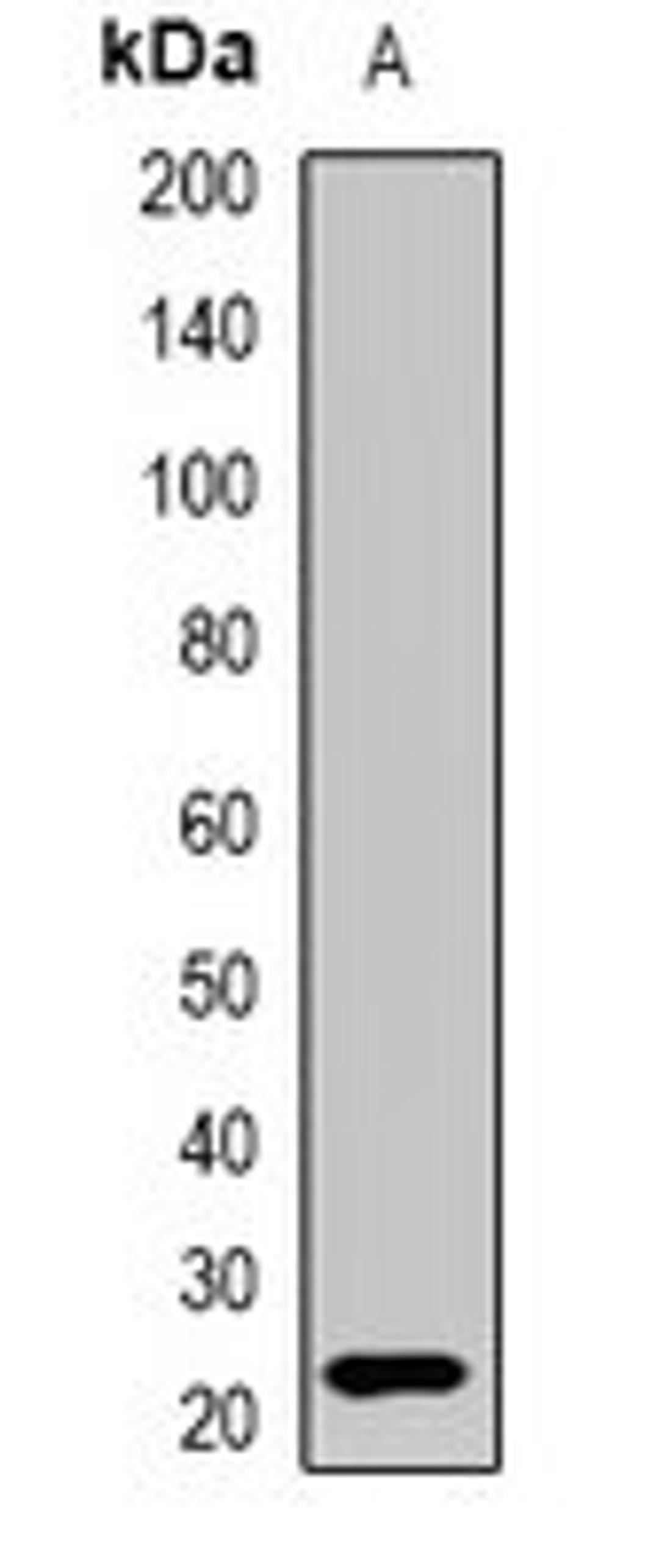 Western blot analysis of HEK293T (Lane1) whole cell lysates using IFNL3 antibody