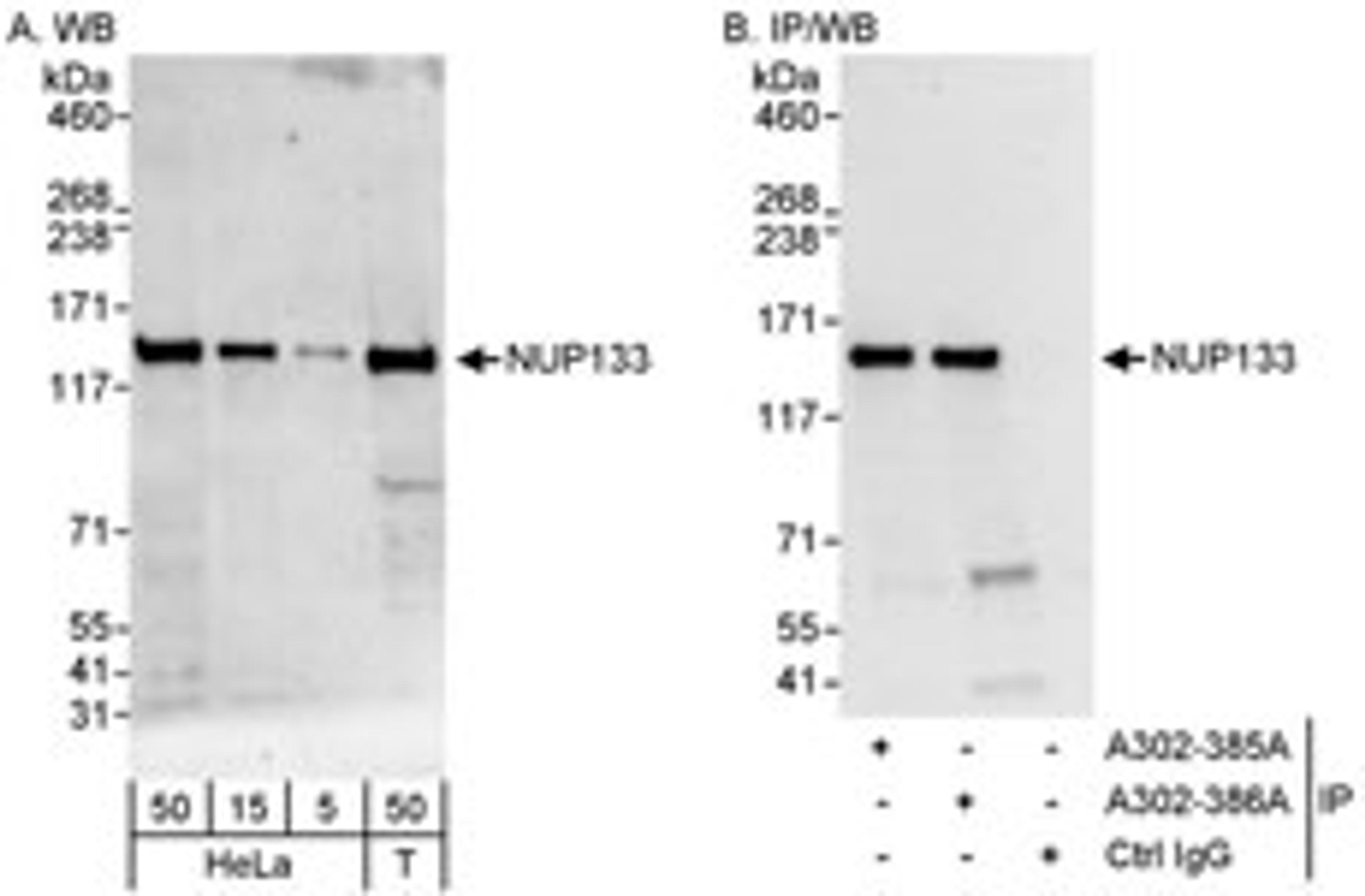 Detection of human NUP133 by western blot and immunoprecipitation.