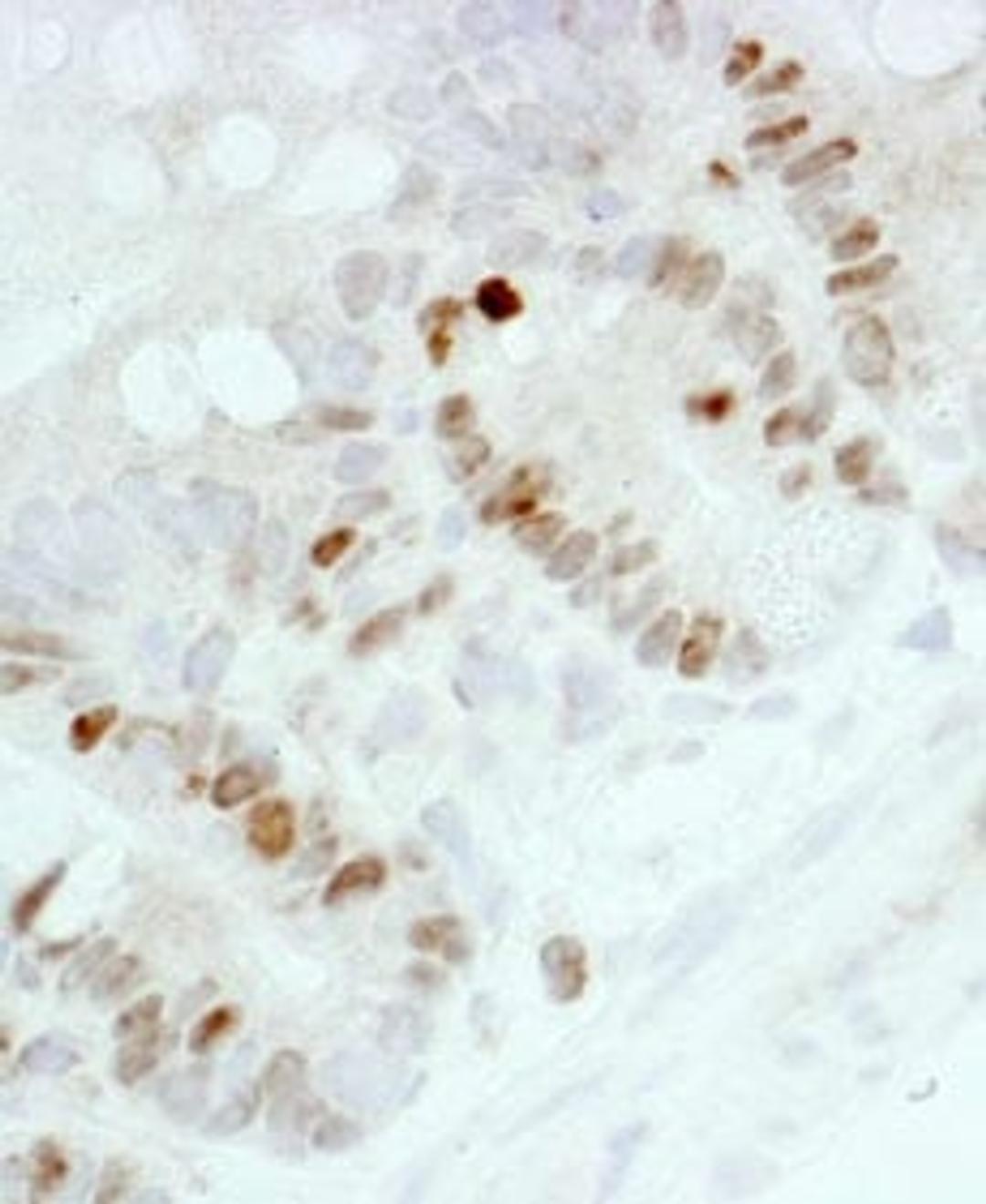 Detection of mouse Ki-67 by immunohistochemistry.