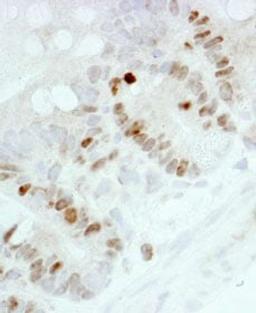 Detection of mouse Ki-67 by immunohistochemistry.