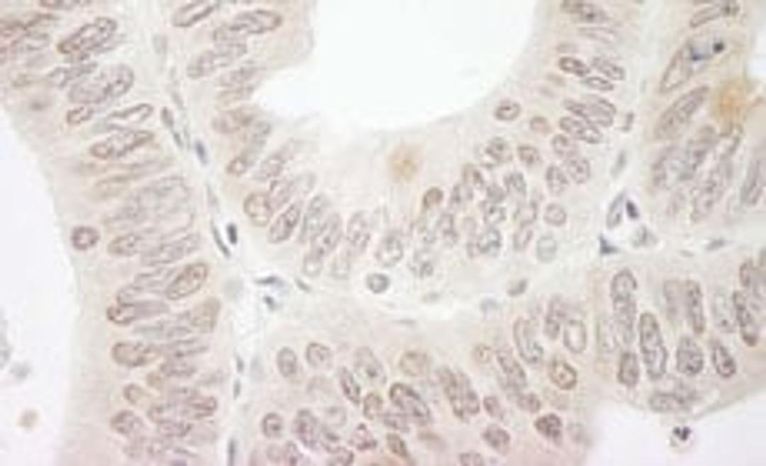 Detection of human DTL/CDT2 by immunohistochemistry.