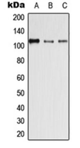 Western blot analysis of HEK293T (Lane 1), SP2/0 (Lane 2), H9C2 (Lane 3) whole cell lysates using DSG4 antibody