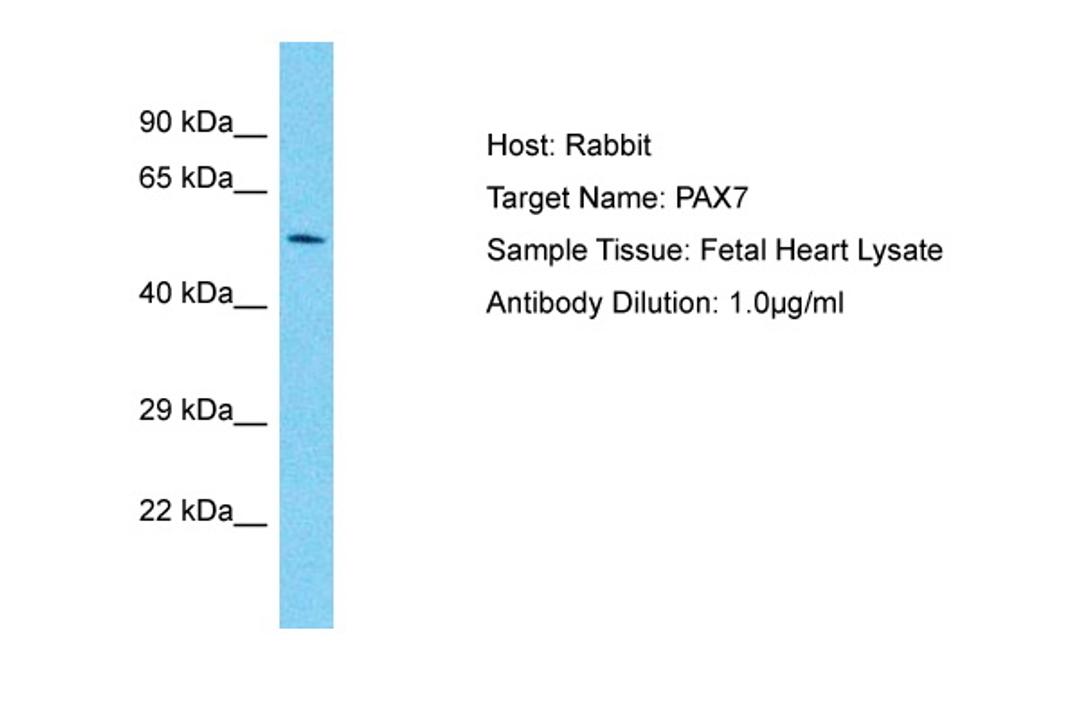 Antibody used in WB on Human Fetal heart at 1 ug/ml.