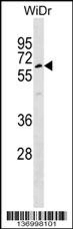 Western blot analysis in WiDr cell line lysates (35ug/lane).