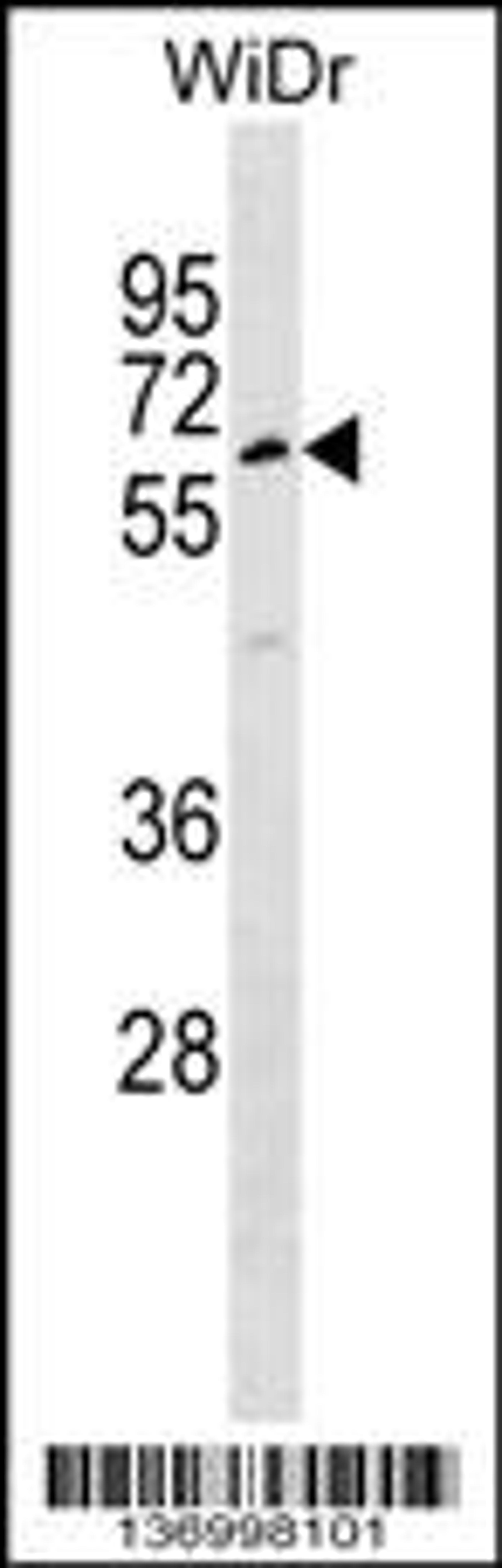 Western blot analysis in WiDr cell line lysates (35ug/lane).