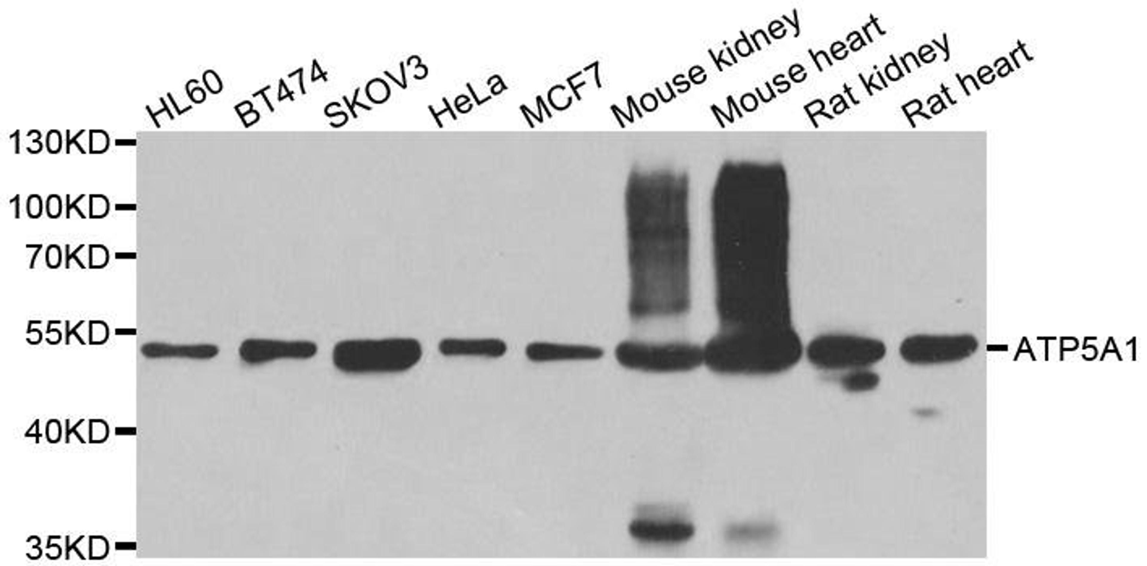 Western blot analysis of extracts of various cell lines using ATP5A1 antibody