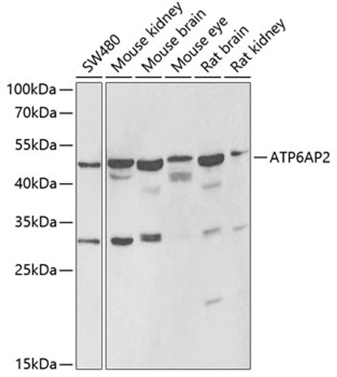 Western blot - ATP6AP2 antibody (A6531)