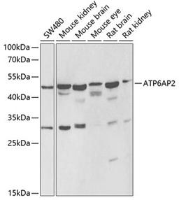 Western blot - ATP6AP2 antibody (A6531)