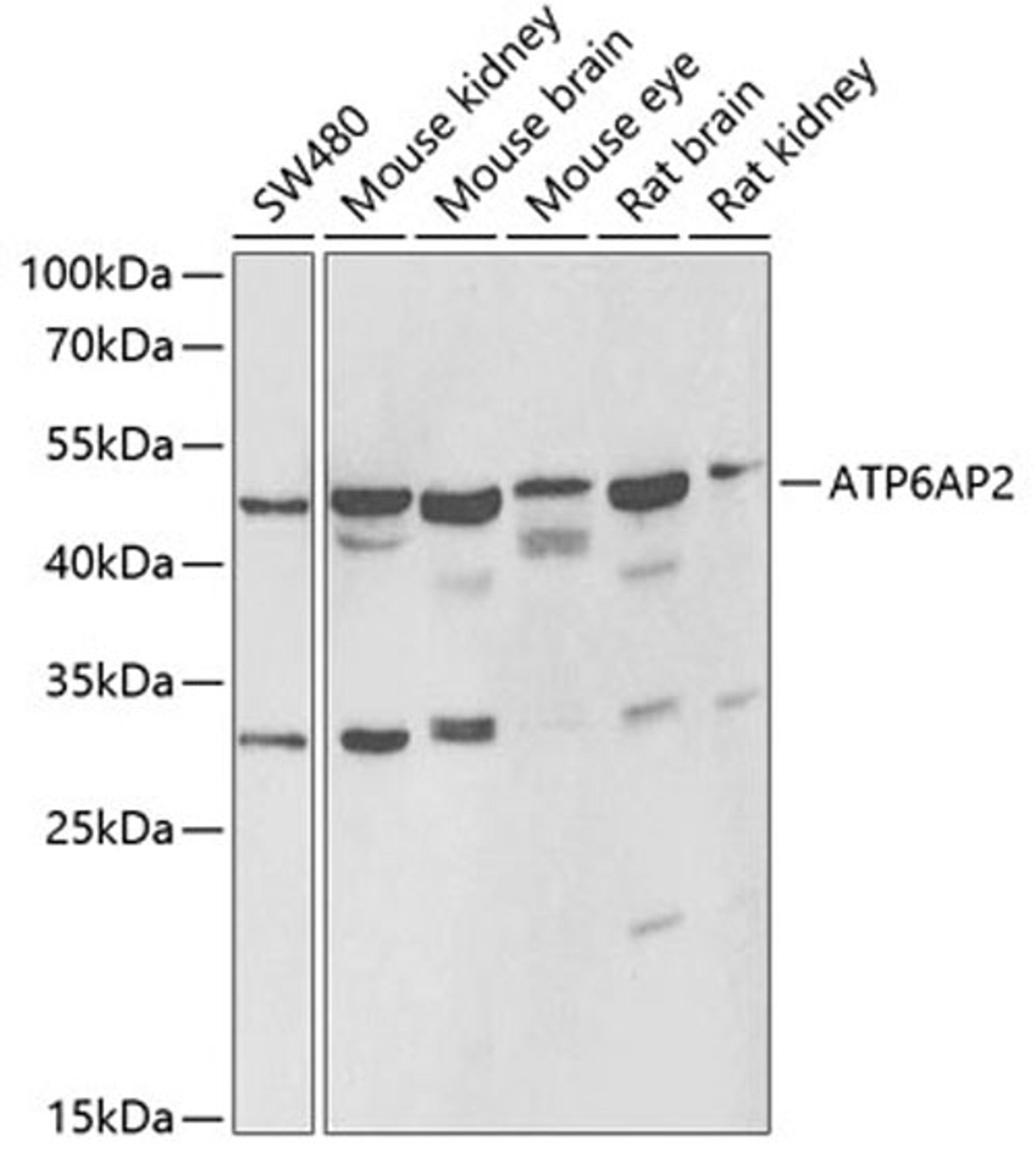 Western blot - ATP6AP2 antibody (A6531)