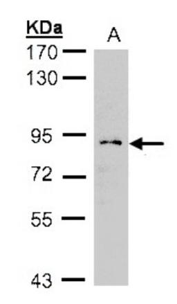 Western Blot: GCS1 Antibody [NBP2-14967] - (30 ug whole cell lysate) H12997. 5% SDS PAGE, antibody diluted at 1:1000.