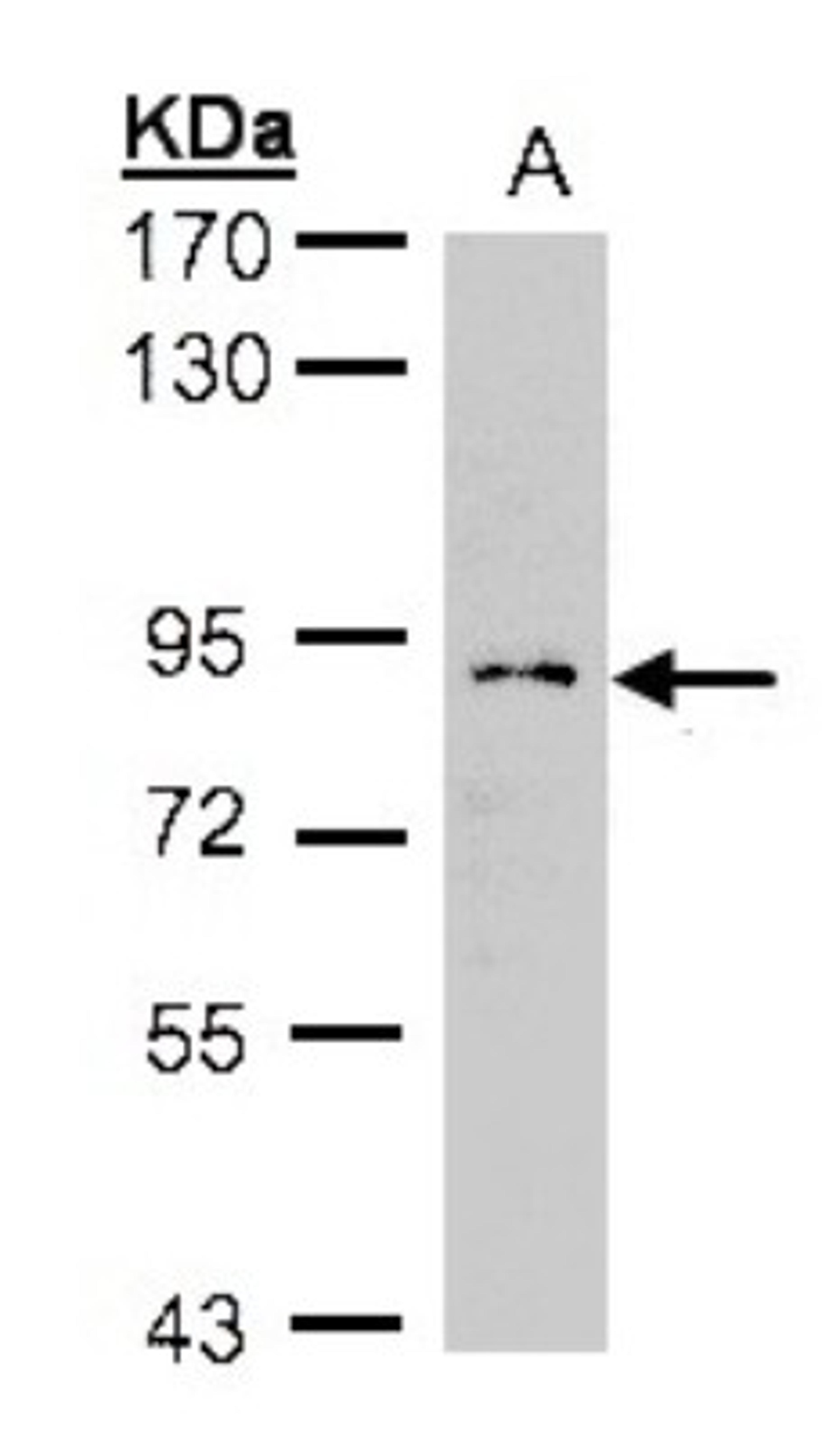 Western Blot: GCS1 Antibody [NBP2-14967] - (30 ug whole cell lysate) H12997. 5% SDS PAGE, antibody diluted at 1:1000.