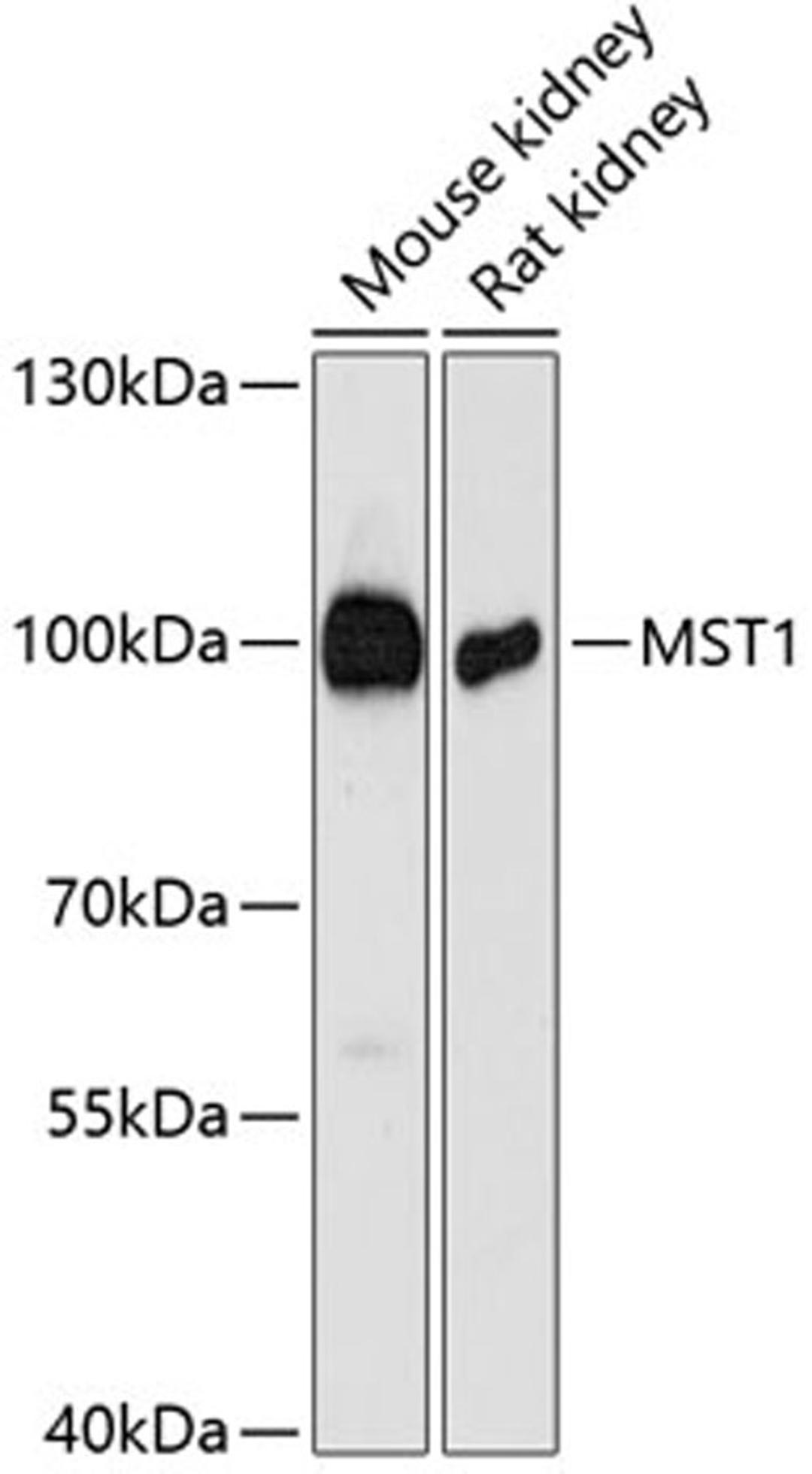 Western blot - MST1 antibody (A12963)