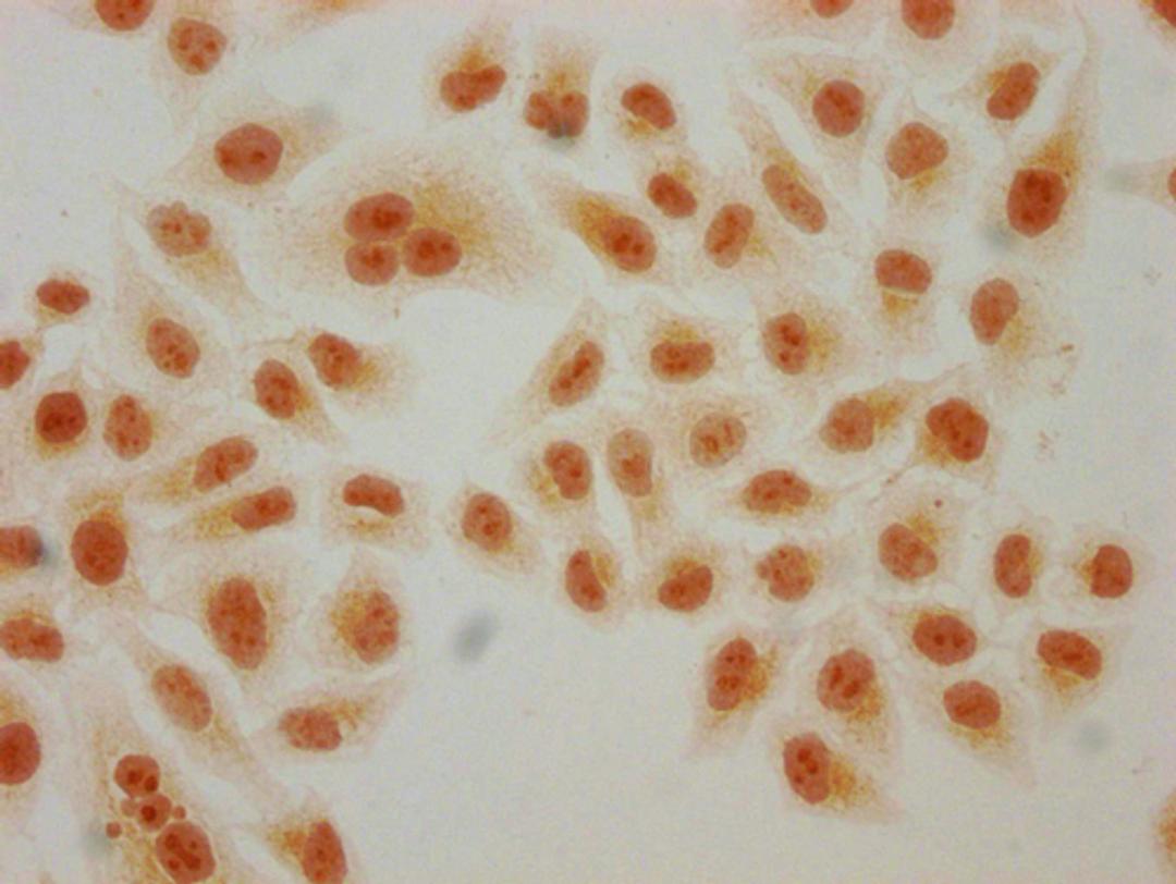 Immunocytochemistry analysis of CSB-PA010429PA91hibHU diluted at 1:150 and staining in Hela cells(treated with 30mM sodium butyrate for 4h) performed on a Leica BondTM system. The cells were fixed in 4% formaldehyde, permeabilized using 0.2% Triton X-100 and blocked with 10% normal goat serum 30min at RT. Then primary antibody (1% BSA) was incubated at 4°C overnight. The primary is detected by a biotinylated secondary antibody and visualized using an HRP conjugated SP system.