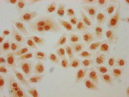 Immunocytochemistry analysis of CSB-PA010429PA91hibHU diluted at 1:150 and staining in Hela cells(treated with 30mM sodium butyrate for 4h) performed on a Leica BondTM system. The cells were fixed in 4% formaldehyde, permeabilized using 0.2% Triton X-100 and blocked with 10% normal goat serum 30min at RT. Then primary antibody (1% BSA) was incubated at 4°C overnight. The primary is detected by a biotinylated secondary antibody and visualized using an HRP conjugated SP system.