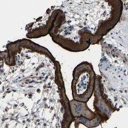 Immunohistochemistry-Paraffin: SIGLEC6 Antibody [NBP1-85756] - Staining of human placenta shows strong cytoplasmic and membranous positivity in trophoblastic cells.