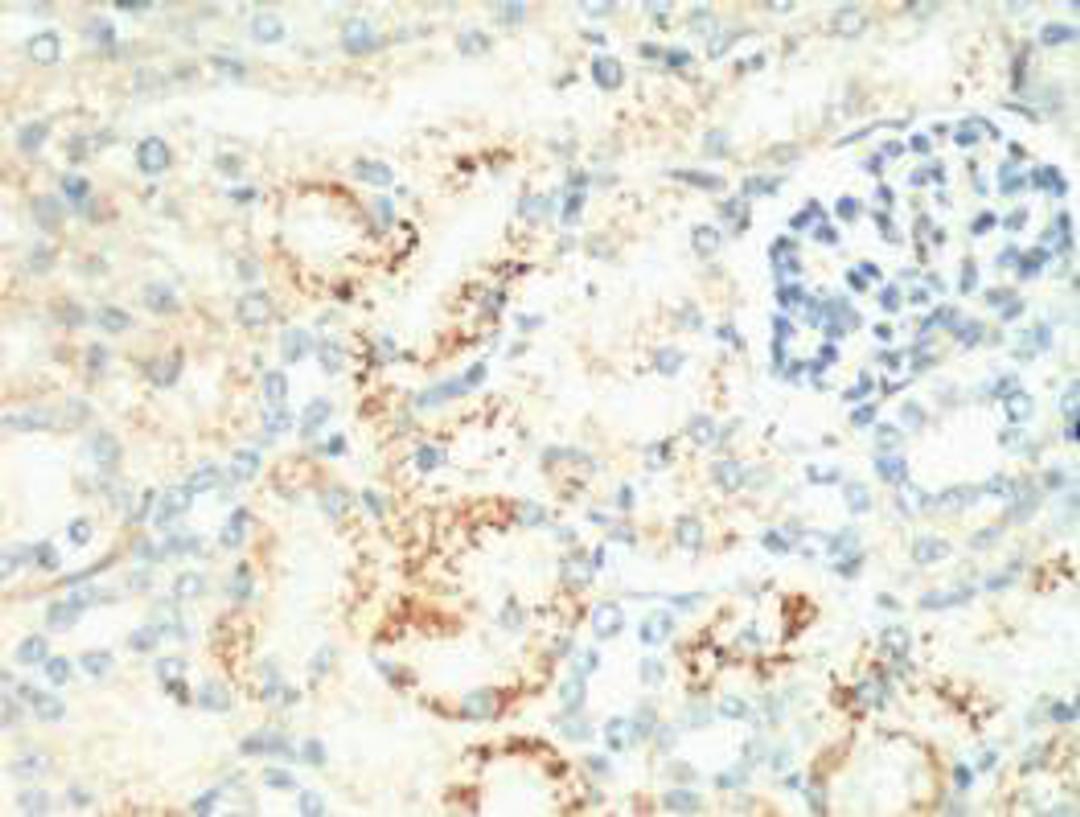 IHC staining of Mouse Kidney tissue, diluted at 1:200.