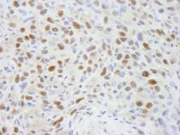 Detection of mouse RBBP7 by immunohistochemistry.