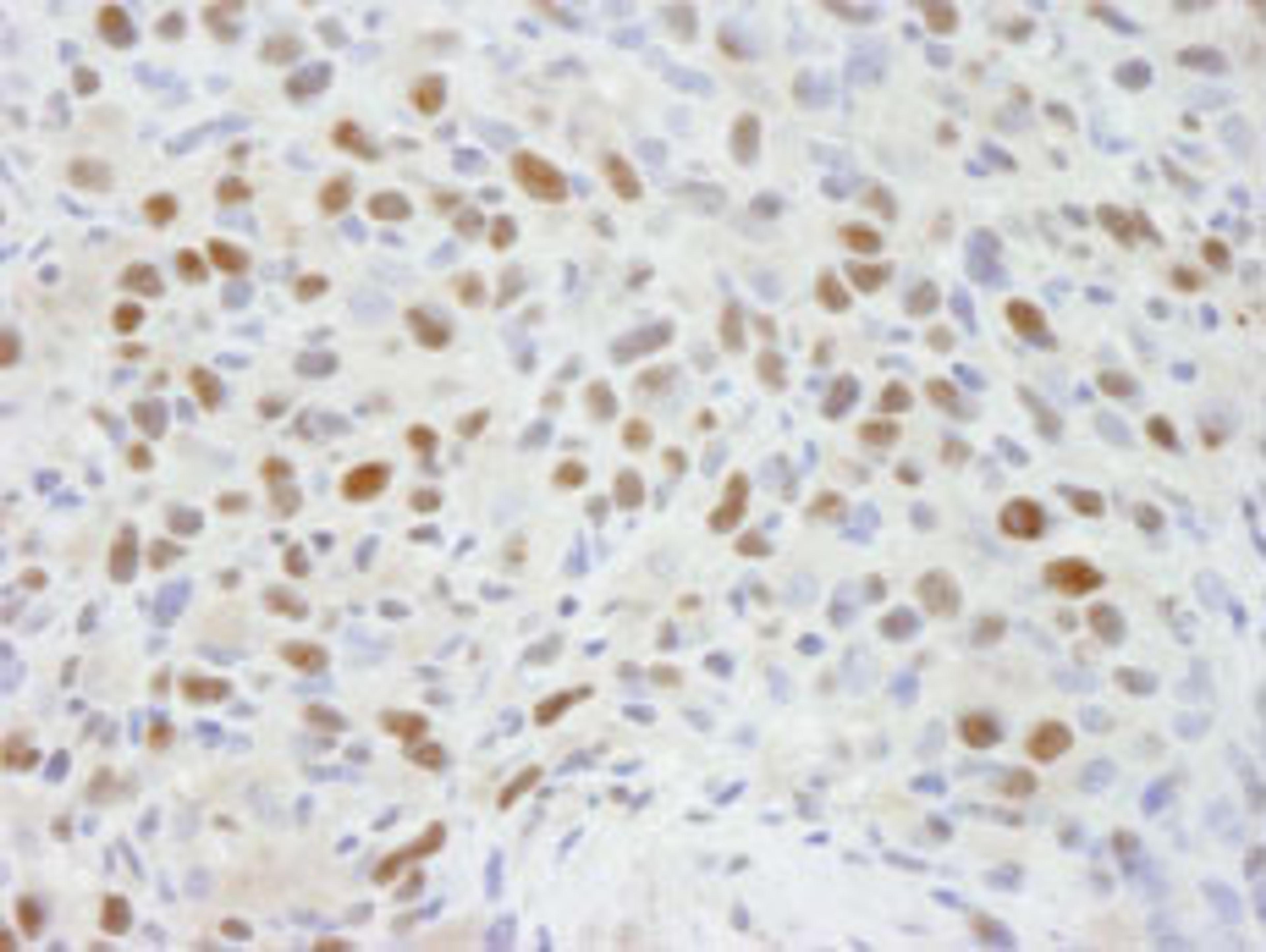 Detection of mouse RBBP7 by immunohistochemistry.