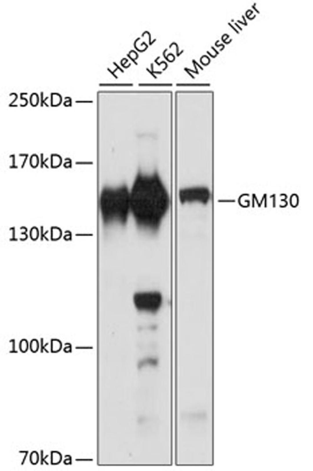 Western blot - GM130 antibody (A16248)